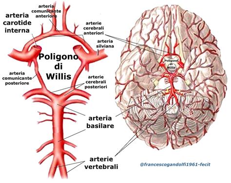 Schema del Circolo Arterioso di Willis