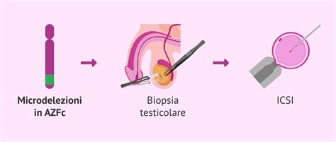 Tecniche di Riproduzione Assistita