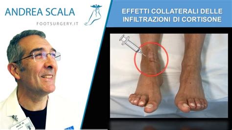 Effetti collaterali comuni dell'idrossiurea sul corpo