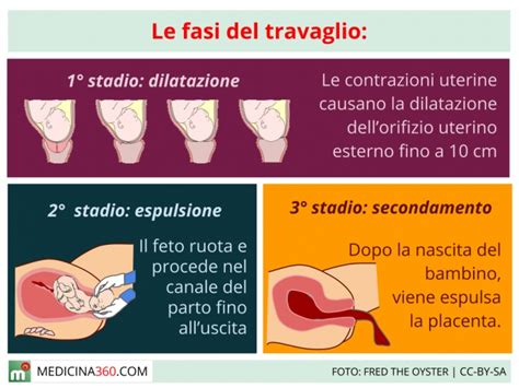 Tabella comparativa delle fasi del travaglio di parto