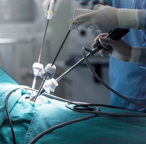 Chirurgia laparoscopica per gravidanza extrauterina