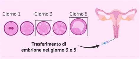 Diagramma del processo di trasferimento embrionale equino