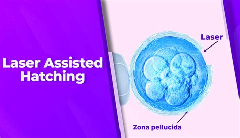 Tecniche di Assisted Hatching