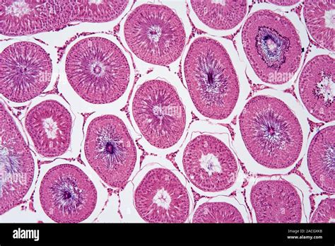 sezione trasversale di un testicolo di teleosteo con spermatocisti