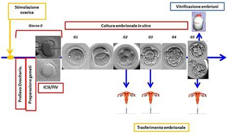 Infografica che illustra le fasi della Fecondazione In Vitro (FIVET)