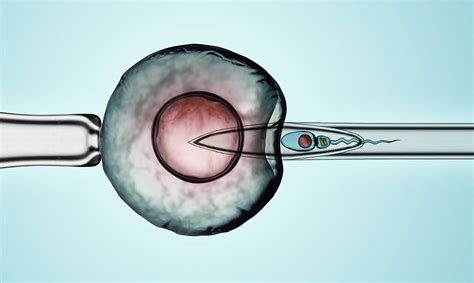 Tecnica di inseminazione postcervicale su scrofa