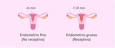 Endometrio uterino sano