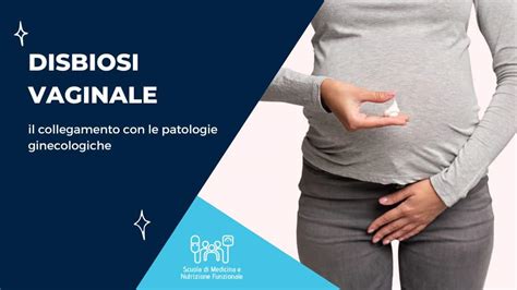 Illustrazione di patologie ginecologiche comuni