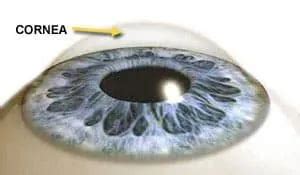 Confronto tra cornea sana e cornea danneggiata, con indicazioni di trapianto