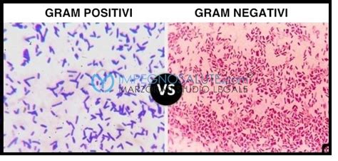Immagine al microscopio di batteri Gram-negativi