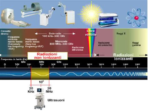 Differenza tra radiazioni ionizzanti e non ionizzanti: un diagramma che illustra lo spettro elettromagnetico e le energie relative delle diverse radiazioni