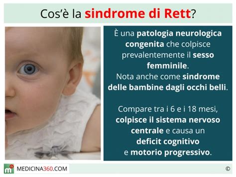Bambina con Sindrome di Rett che utilizza un comunicatore oculare (Amelie)