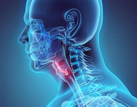 Immagine che mostra l'epiglottide infiammata