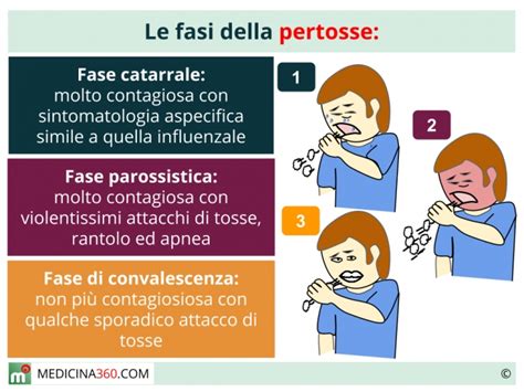 Schema che illustra le tre fasi della pertosse: catarrale, parossistica e di convalescenza