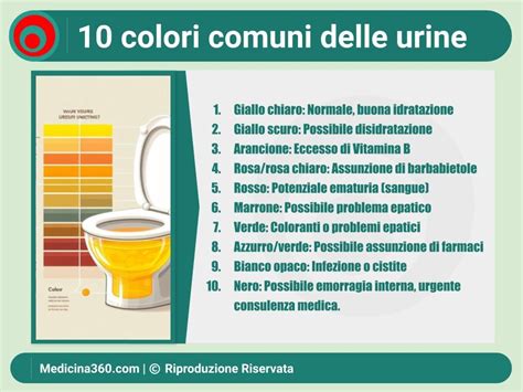 Dettaglio di un'analisi delle urine