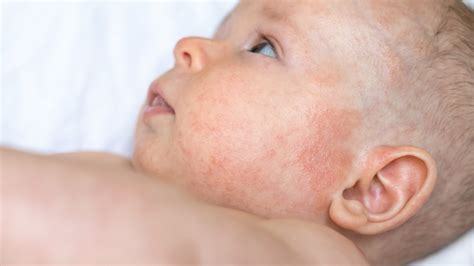 Pelle delicata di neonato