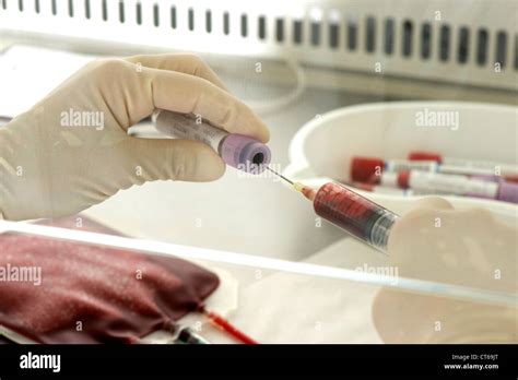 Sangue del cordone ombelicale in provetta