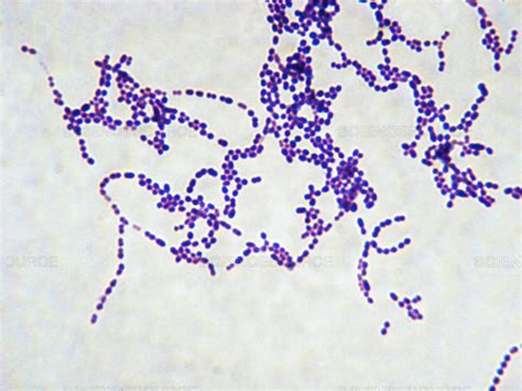 Microscopio che ingrandisce lo Streptococcus pyogenes