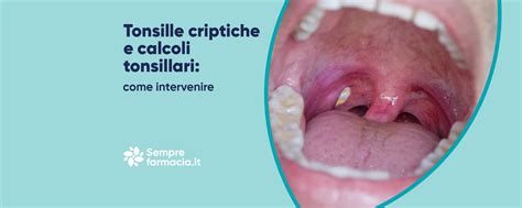 Bambino con mal di gola che indica le tonsille
