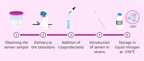 Diagram showing sperm cryopreservation process