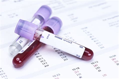 Donne incinte che fanno un test di tolleranza al glucosio orale