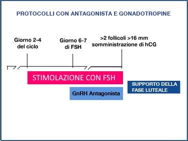 Schema dei diversi protocolli di stimolazione ovarica (agonista vs antagonista)