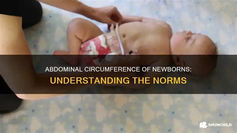 Newborn with abdominal discomfort