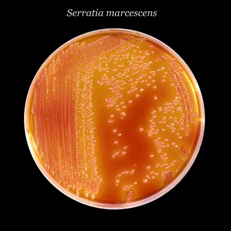 Microscopia elettronica di Serratia marcescens