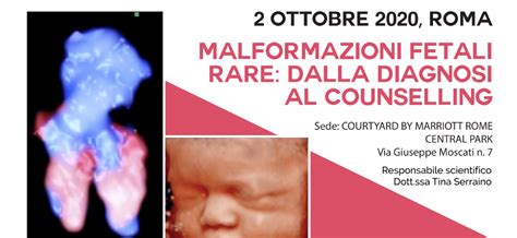 Tipi di malformazioni congenite degli arti