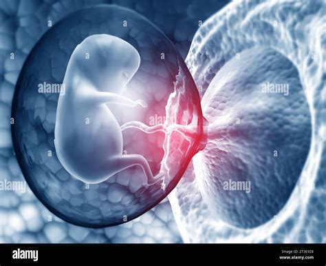 Illustrazione dell'utero gravido che comprime le vene pelviche