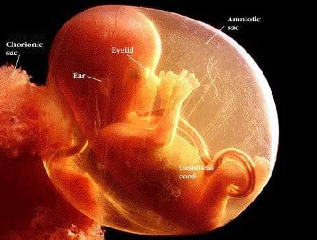 Bambino appena nato all'interno del sacco amniotico intatto