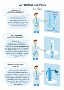 diagramma esplicativo del funzionamento di una protesi peniena idraulica tricomponente