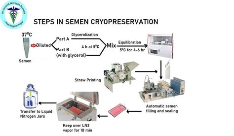 Flowchart of semen analysis and cryopreservation
