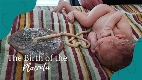 Placenta umana attaccata alla parete uterina