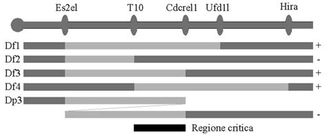 Rappresentazione schematica delle anomalie fetali associate all'AOS