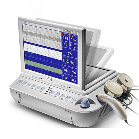 Schermo di un Doppler fetale con indicazioni FHR e qualità segnale