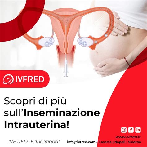 Diagramma di Inseminazione Intrauterina (IUI)