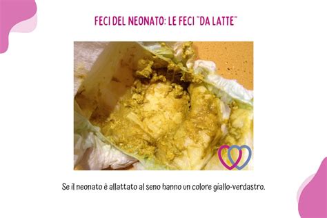 Feci gialle senape di neonato allattato al seno