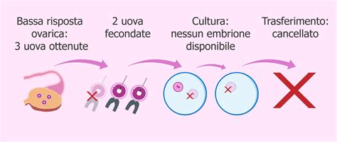 Diagramma che illustra i fattori che predicono una bassa risposta ovarica
