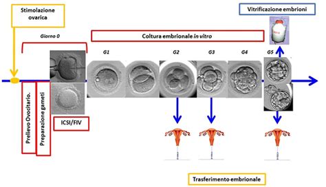 Diagramma delle diverse fasi della fecondazione in vitro