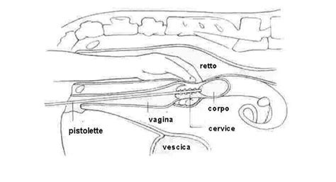 schema dettagliato dei componenti della pistolette per inseminazione