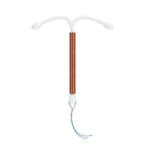 rappresentazione schematica di un dispositivo intrauterino a forma di T inserito nell'utero