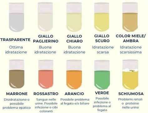 Tavola colori del liquido amniotico (normale, tinto di meconio, giallo/marrone, rosso)