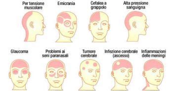 diagramma delle cause del mal di testa ormonale