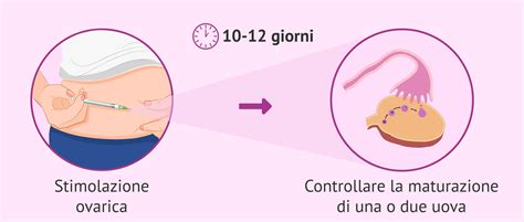Processo di stimolazione ovarica