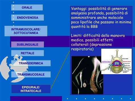 Schema dei possibili effetti collaterali dell'analgesia epidurale