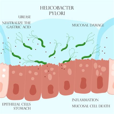 rappresentazione grafica del batterio Helicobacter pylori nello stomaco umano