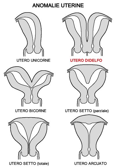 rappresentazione anatomica semplificata dell'utero didelfo per scopi educativi