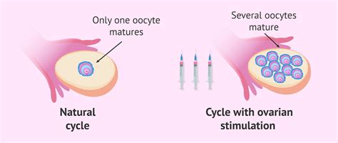 Ovarian stimulation process diagram