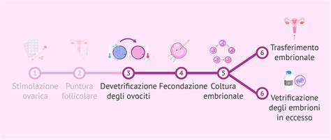Diagramma delle tecniche di fecondazione in vitro